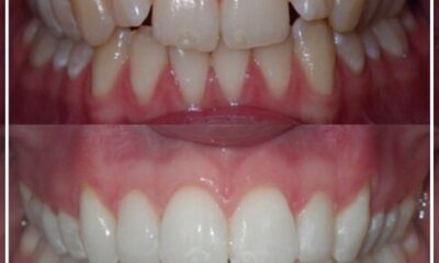 5b4170d4768a4b84ab803953f41a1a55